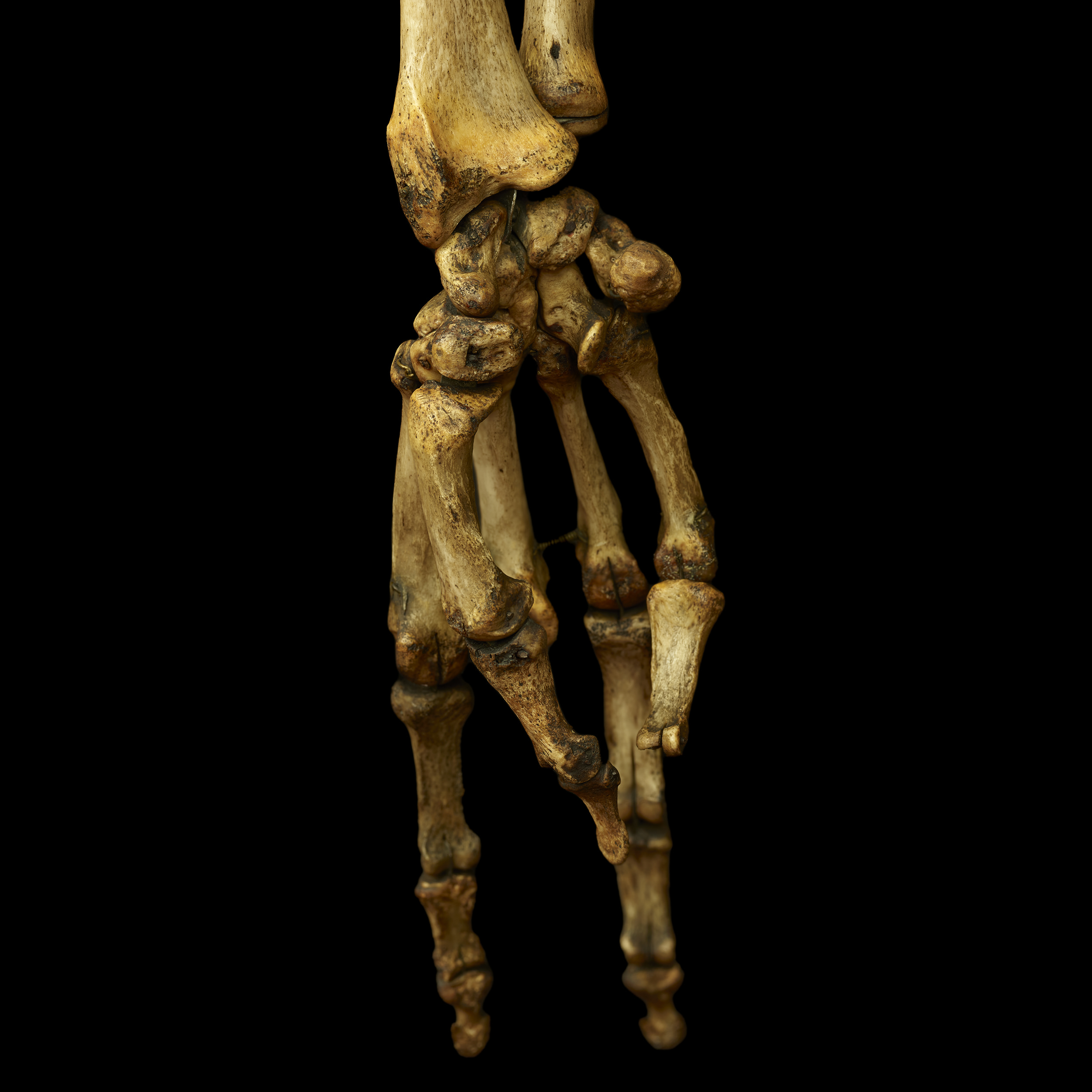 close up detail shot of a skeleton hand and wrist, colour on black background, facing down