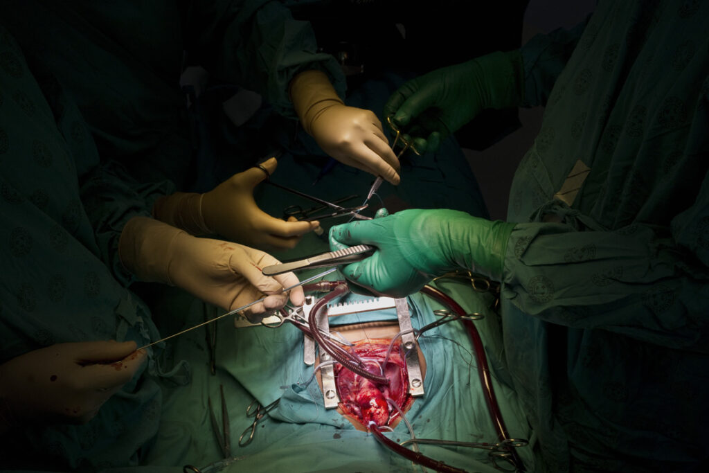 Various gloved surgeons' hand and surgical implements above the patients body