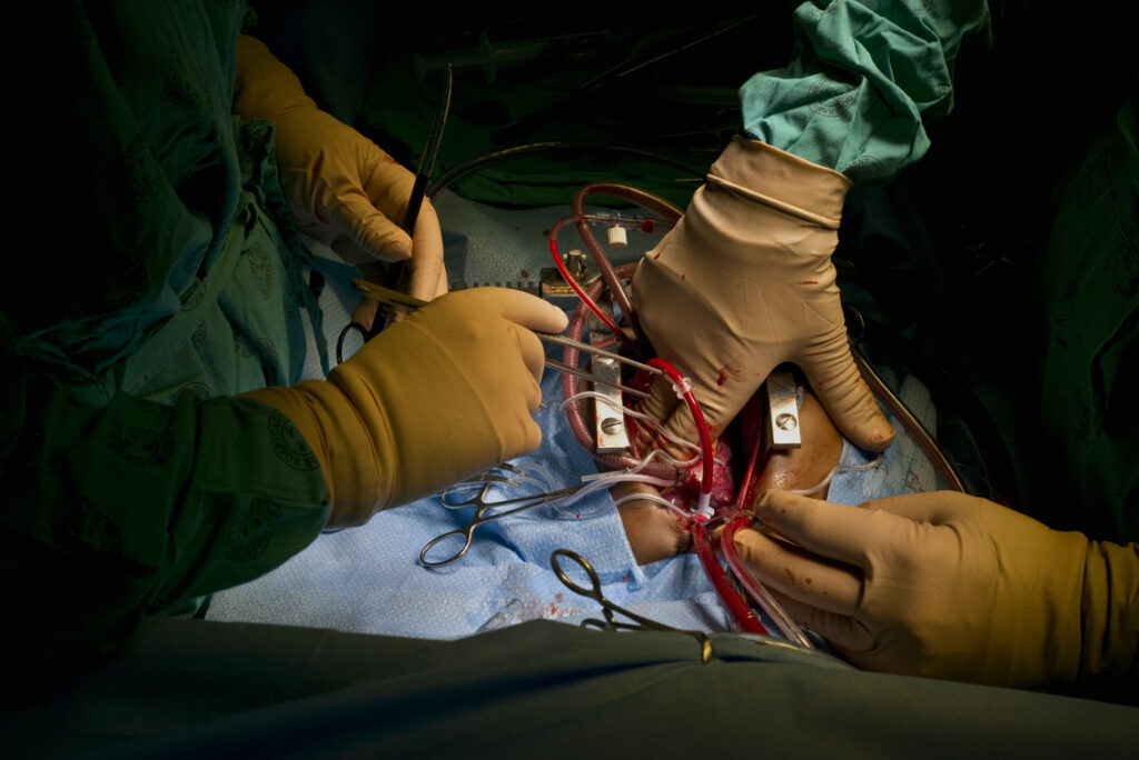 Various gloved surgeons' hand and surgical implements above the patients body