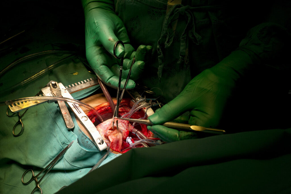 Various gloved hands of surgeons, tubes and surgical implements above patient's body