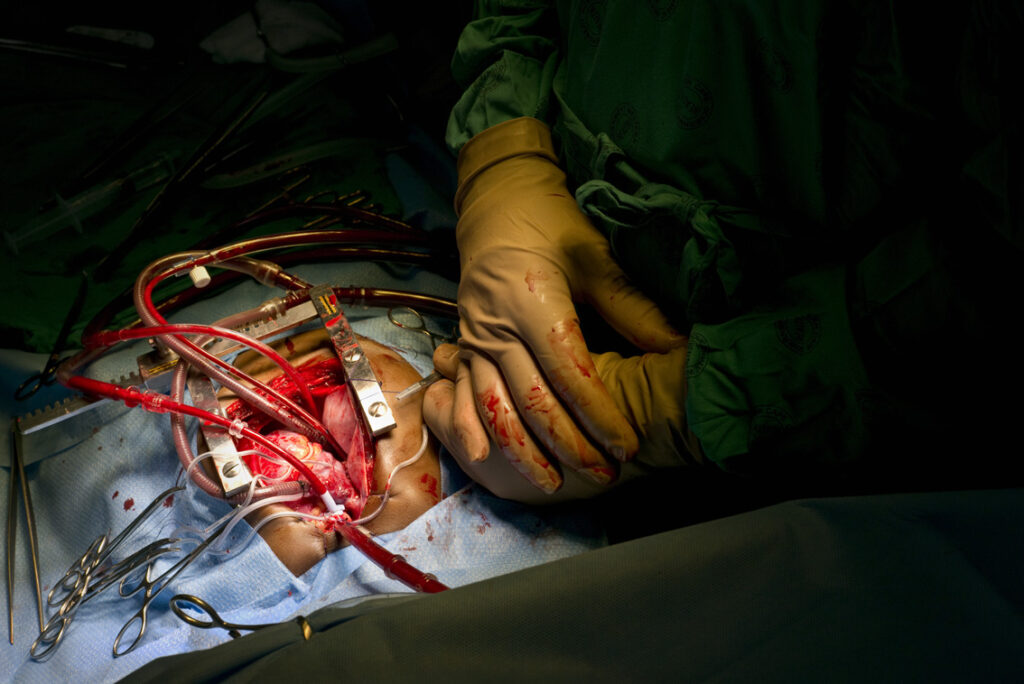One pair of gloved Surgeon's hands and surgical implements above the patients body