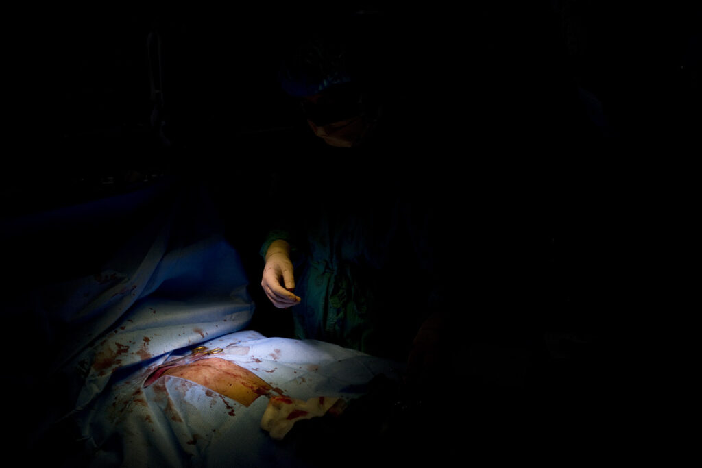 Surgeon’s hand at end of procedure with skin closed