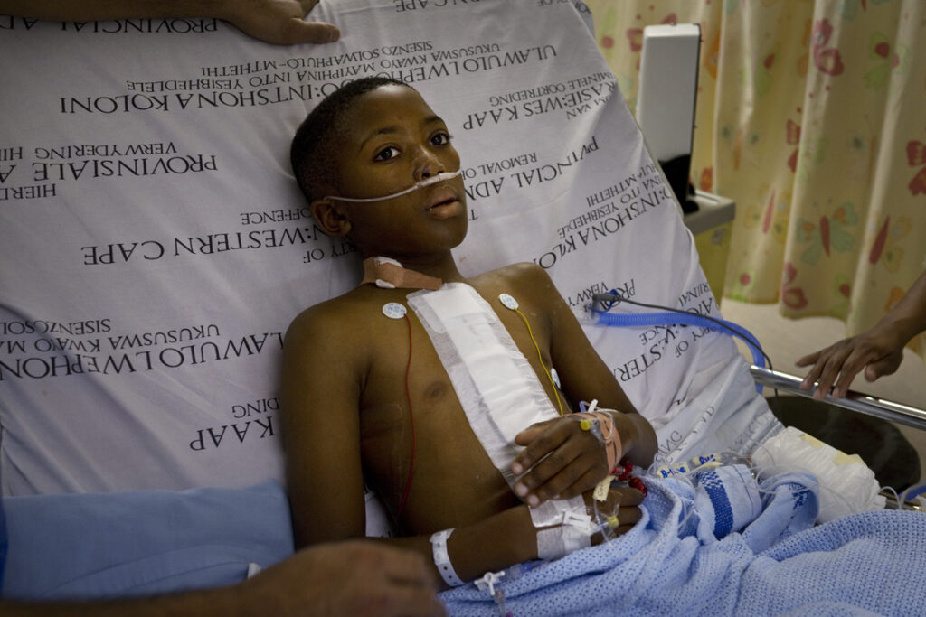 Patient in ICU after extubation, image shows young patient lying on a bed in hospital ward.