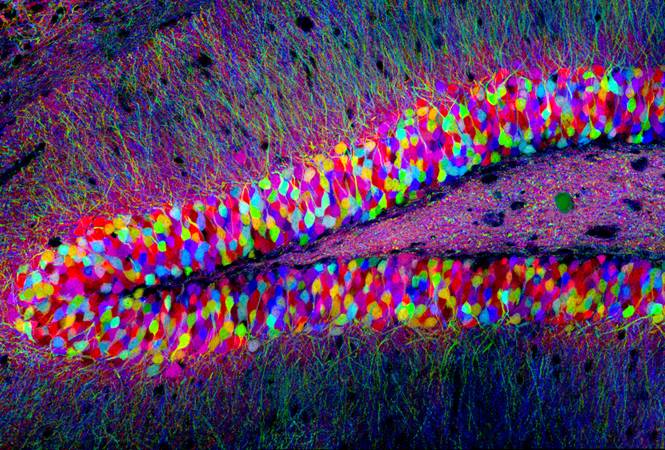 Image showing neurons stained multiple bright colours.