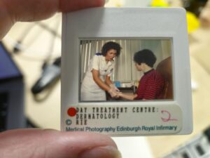 a photographic slides being held up white white edges with a small window, the photograph is a female nurse in a white uniform examining a woman wearing a red and black horizontal striped tops forearm