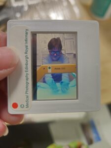 a photographic slides being held up white white edges with a small window, the photograph is a female person in medical clothes and gloves holding there hands under a bright UV light